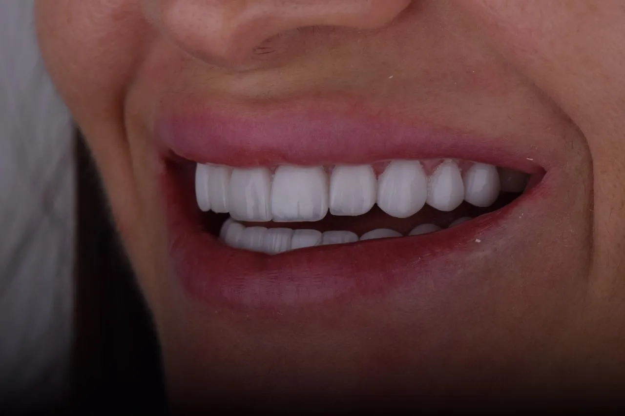 Featured Dental Work