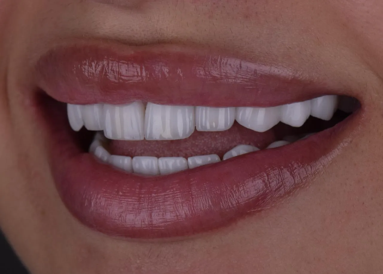 Featured Dental Work